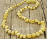 SALE - Baltic Amber Necklace - Polished Variegated - Sizes 10.5-15
